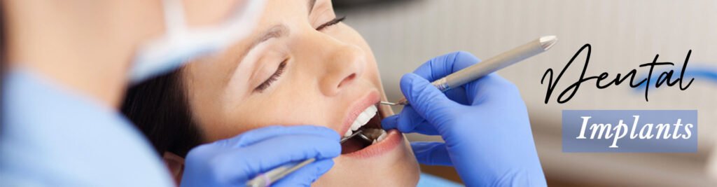 Seven devices each dental specialist ought to use for dental inserts